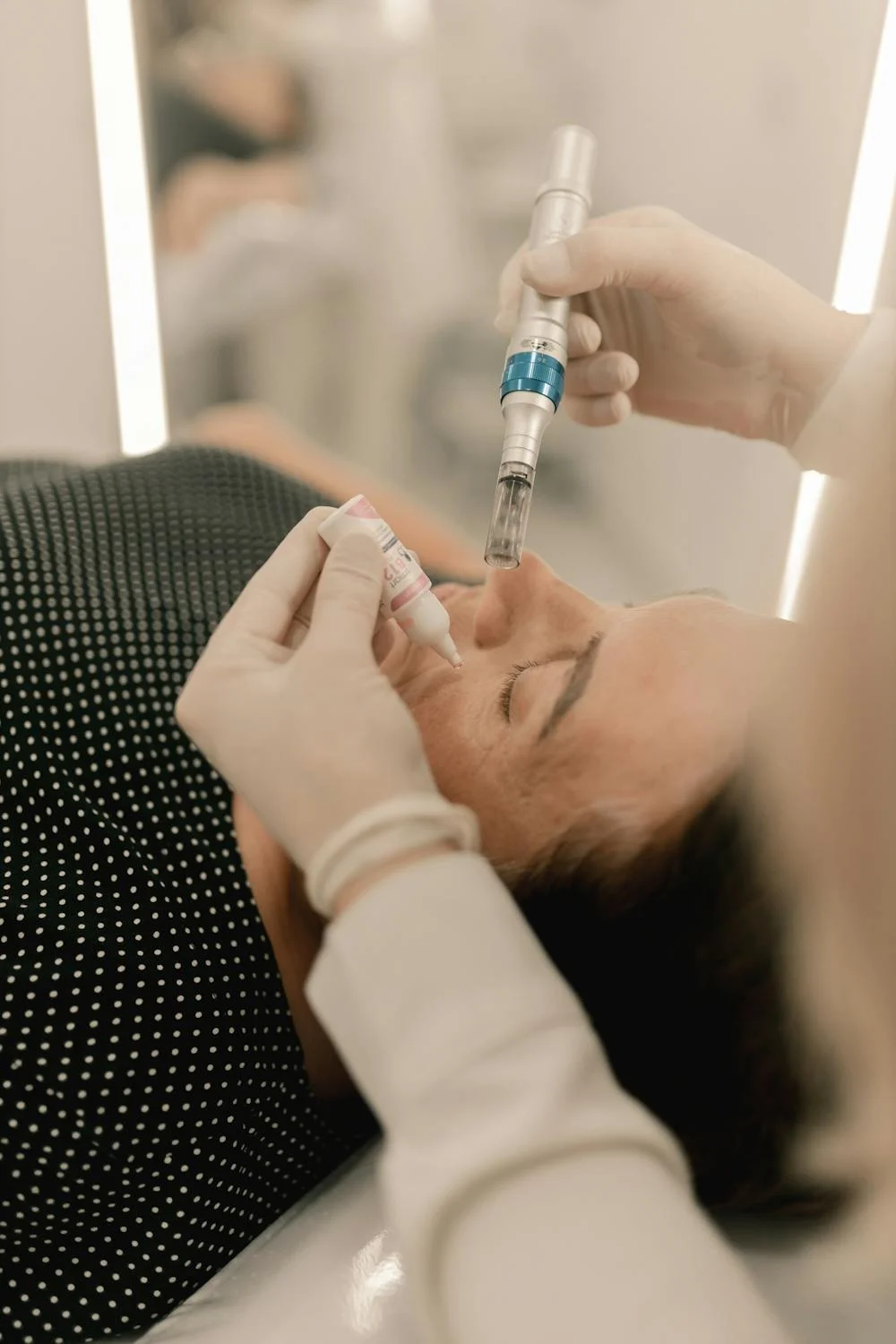 Microneedling: the delicate process, perks, and what to expect