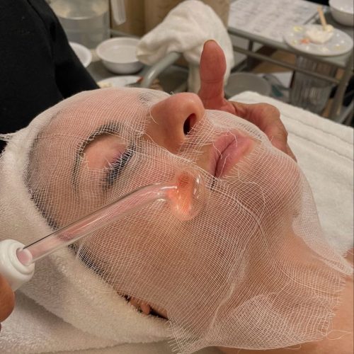 A Guide to Chemical Peels and Their Role in Brightening Skin and Reducing Imperfections