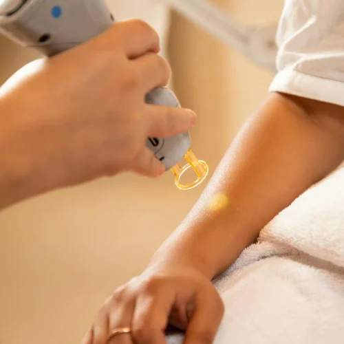 Achieve Glowing Skin: A Deep Dive into Fractional and IPL Laser Treatments