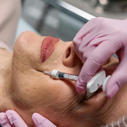 Botox for a Youthful Glow: All You Should Know