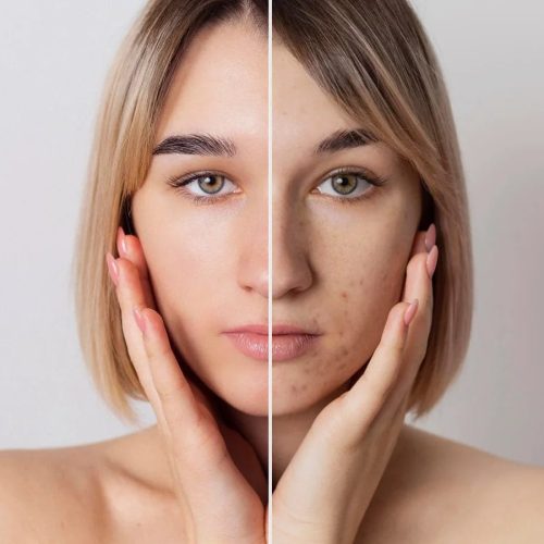 The Science Behind Glowing Skin: 5 Key Habits for Radiance